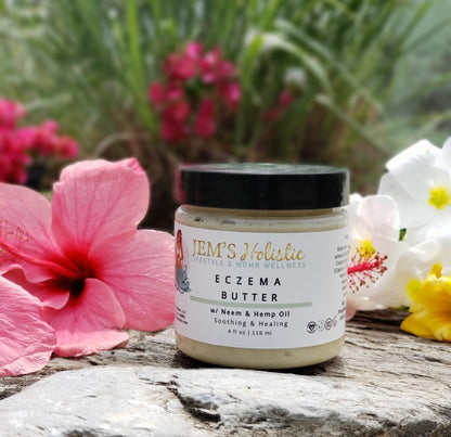 Eczema Butter Balm